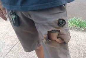 Мужчина спасся от огромных собак благодаря взрыву мобильного телефона в кармане