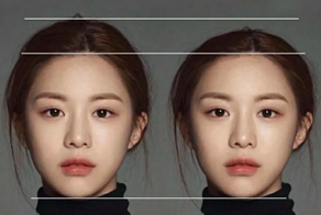 В Китае набирает популярность необычный тренд — увеличение формы головы