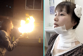 «Огнедышащий трюк» с праздничным тортом стал причиной ожогов