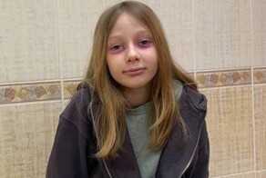 Женщина неделю лечила 10-летнюю дочь от редкой болезни, которую та нарисовала себе под глазами