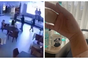 Женщина лишилась двух фаланг пальцев, упав вместе со столом