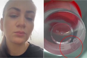 Опасный укус: комар занёс паразита в глаз жительницы Дагестана