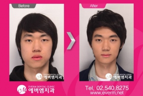 До и после пластической хирургии (31 фото)