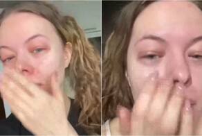 Жительница Воронежа чуть не задохнулась после выпитого протеина