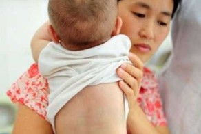 Ребенок родился с хвостом (4 фото)