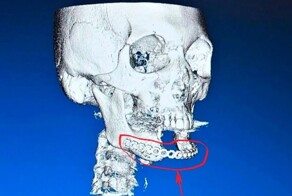 Очередное доказательство того, что для врачей нет ничего невозможного