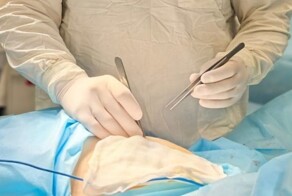 34 метастатических опухоли обнаружили у молодой женщины