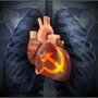 Призыв: Новое Советское Сердце