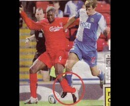 Футбольные травмы