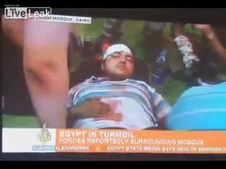 Фейковое ранение