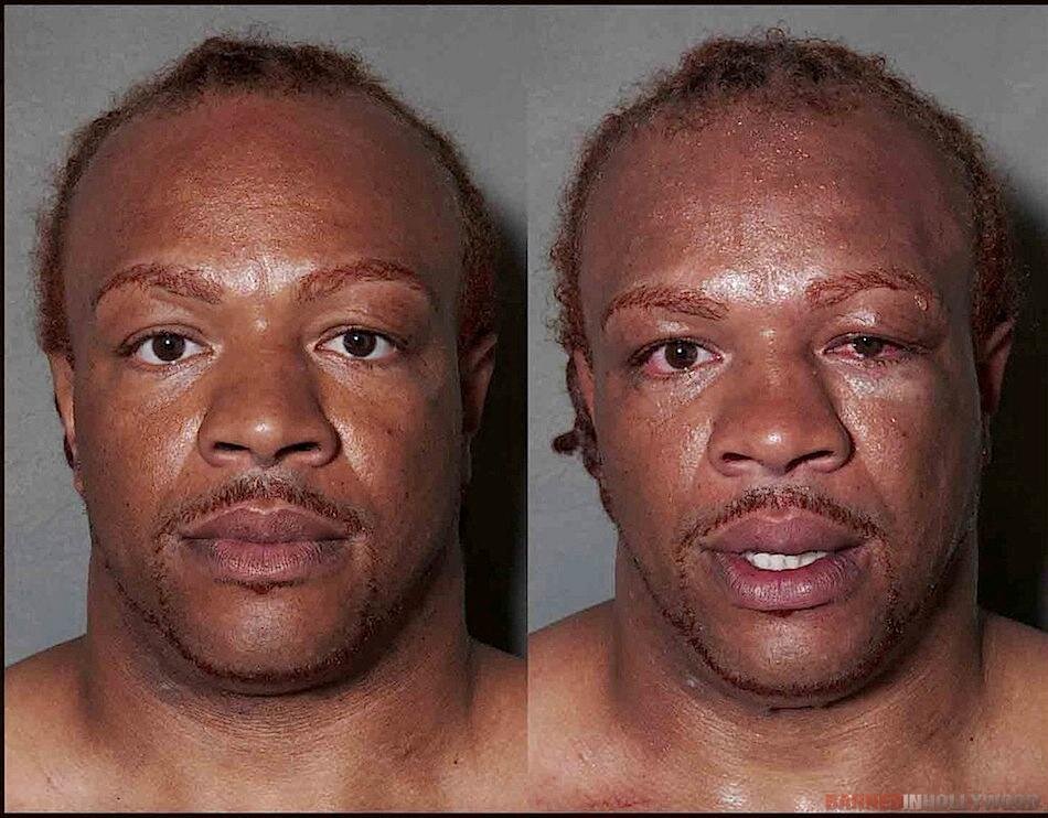 Boxers Before and After Fight 