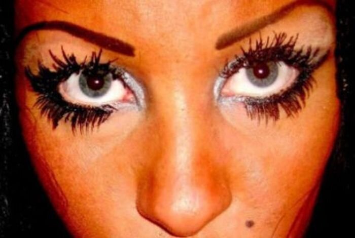 Жертва пластической хирургии (7 фото)