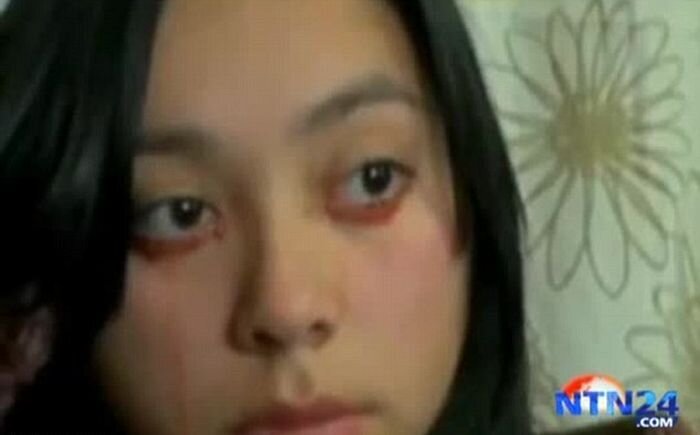 Девушка, плачущая кровью (4 фото)