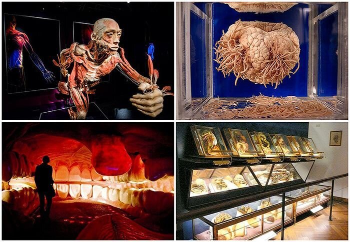 6 самых шокирующих анатомических музеев мира (11 фото)