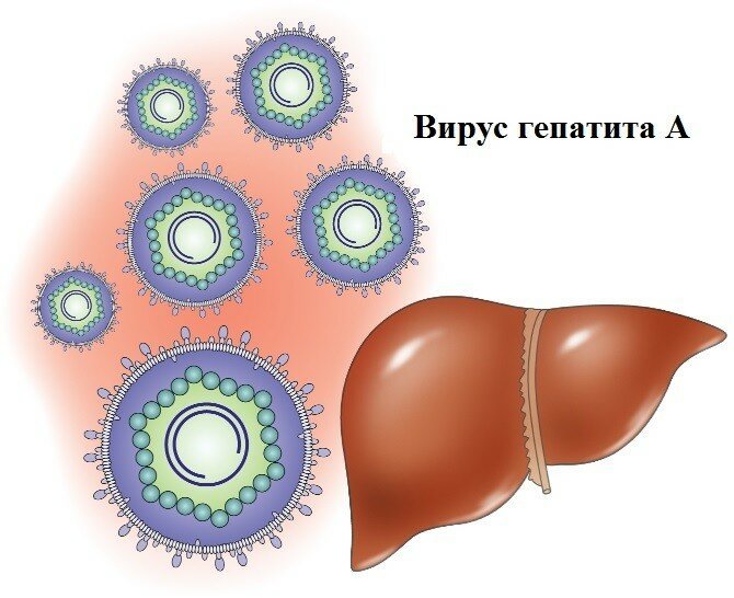 Гепатит А (болезнь Боткина, "желтуха")