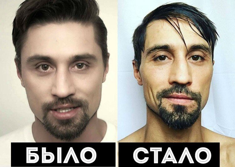 "Я не специально". Звезды, поразившие экстремальным похудением (24 фото) 