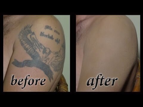 Как можно скрыть татуировку или другие недостатки кожи с помощью грима