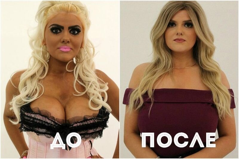 Фанаты пластики, которые вернулись к нормальному виду (27 фото) 