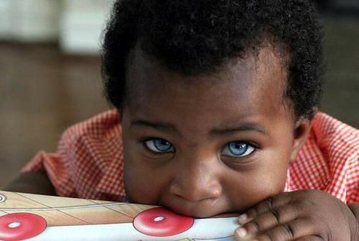 Африканский ребенок с голубыми глазами (7 фото)