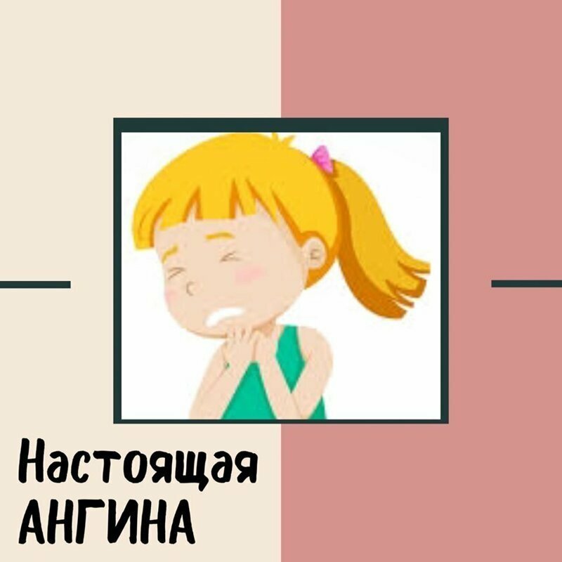 Как поставить диагноз ангины