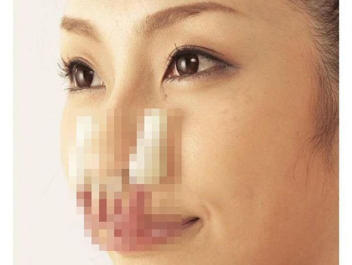 Исправляем форму носа без операции (2 фото)