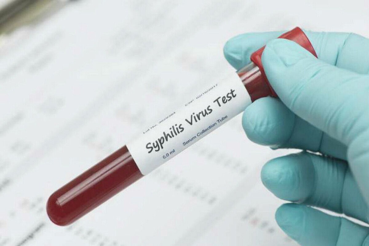 Кровь рв вич. Исследование крови на сифилис. Исследование крови на реакцию Вассермана. Пробирка для крови на сифилис.