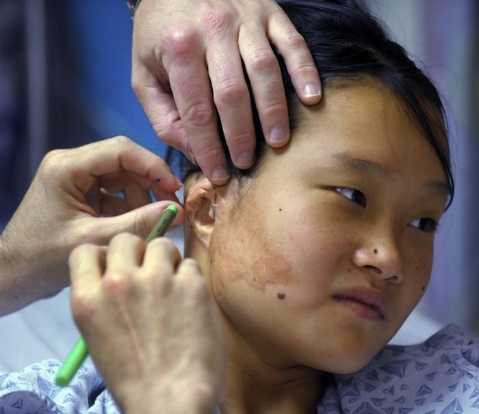 Девушка получила новое ухо (4 фото)