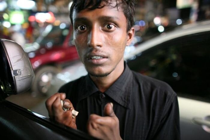 Нищие Читтагонга  (6 фото + текст)