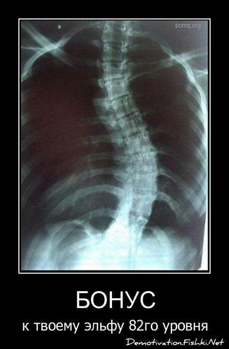 Смешной демотиватор от zubrilov за 20.05.2011 №77357