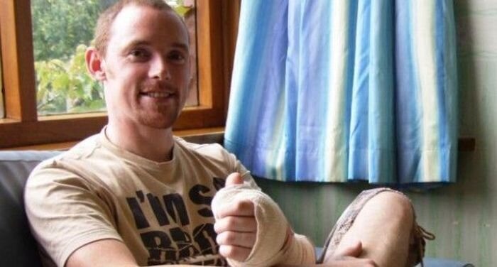 Хирурги заменили британцу большой палец руки на палец левой ноги (4 фото + 1 видео)