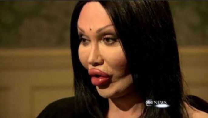 Plastic Surgery Fails 