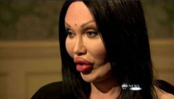 Plastic Surgery Fails 