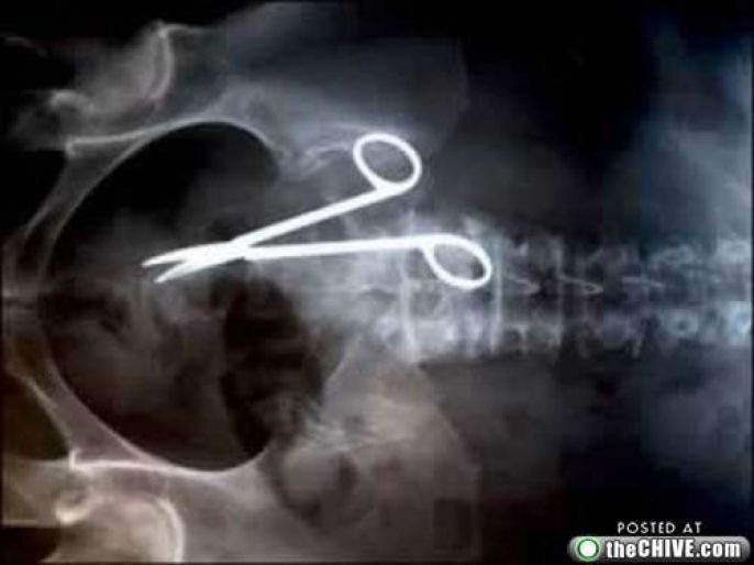 Scary X-rays Photos That Will Make You Cringe
