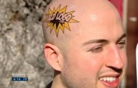 Creative Solutions for Baldness