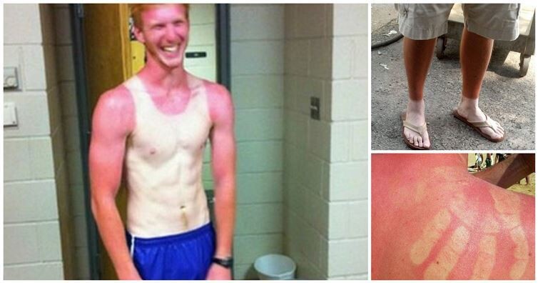 14 Times People Got Totally Burned