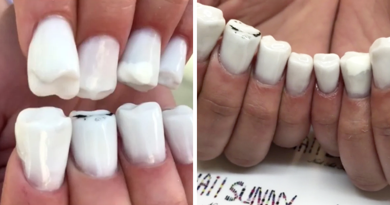 Teeth-Nails Exist, And If You Think They Can’t Get Any Worse, Watch This Video