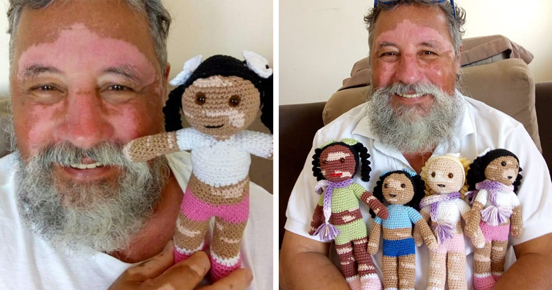 Grandpa With Vitiligo Crochets Dolls To Encourage Kids Who Suffer From This Condition