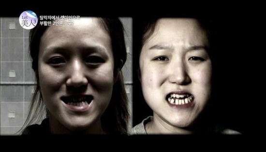 Преображение южнокорейских близнецов