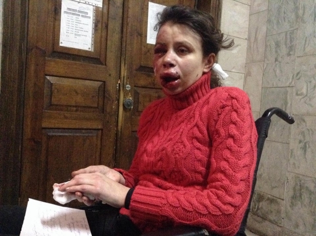 Избита активистка "майдана" Татьяна Черновол