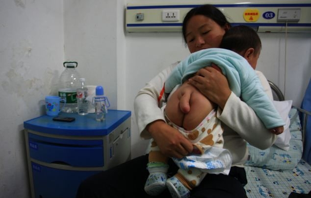 Китаянка умоляет врачей отрезать ее младенцу хвост