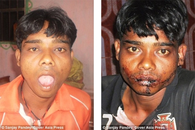 Индийский подросток отрезал себе язык во славу Шивы