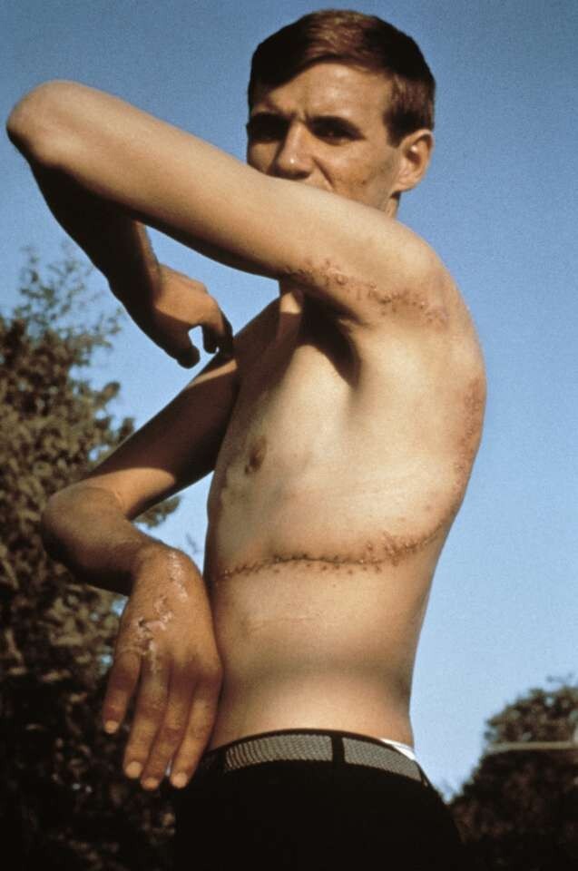 7 самых жутких нападений акул в истории