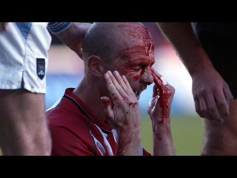 Самые страшные травмы в истории футбола