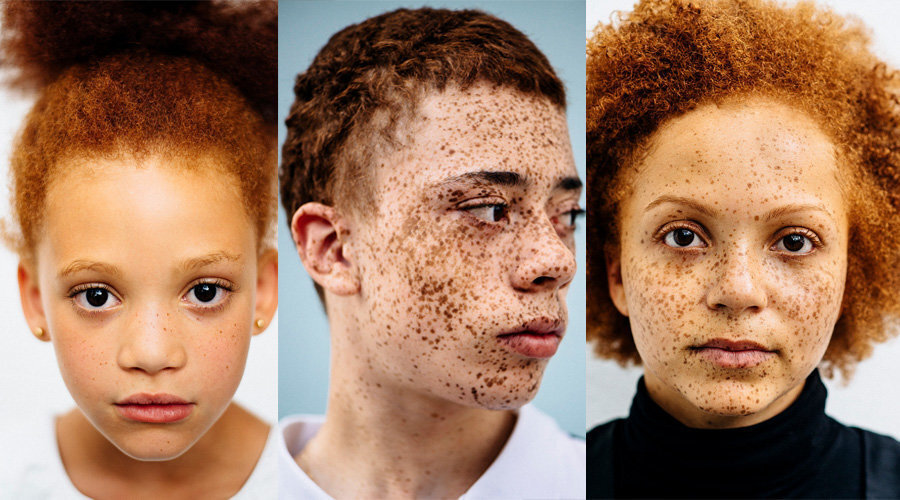 Фотограф сделал портреты рыжеволосых людей с веснушками, чтобы разрушить стереотипы