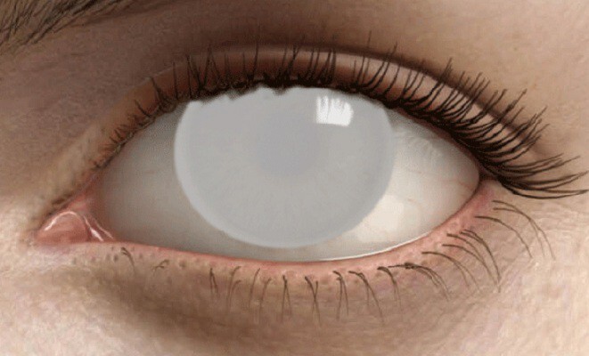Искусственно выращенные клетки сетчатки возвращают зрение слепым