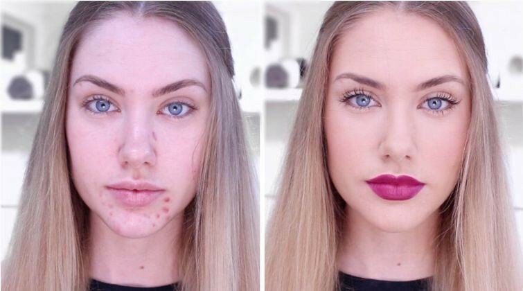 Чудеса маскировки: как косметика преображает обладательниц проблемной кожи