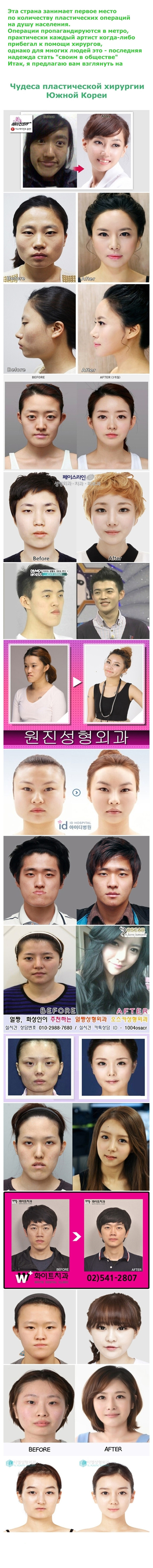 Чудеса пластической хирургии Южной Кореи
