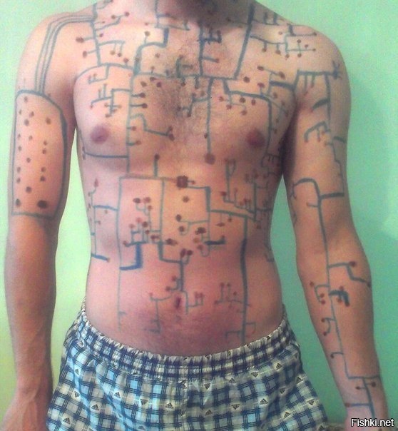 Программист и ветрянка