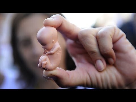 Что будет, если гомункул существует?!