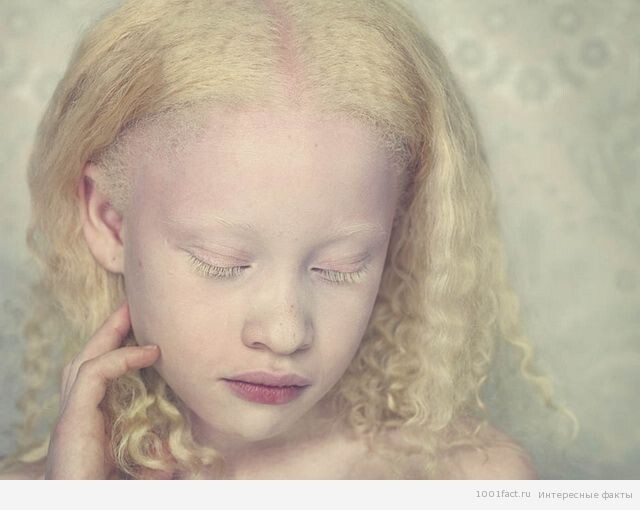 О людях — альбиносах